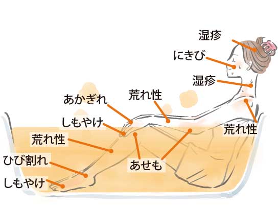 湿疹、にきび、荒れ性、あかぎれ、あせも、しもやけ、ひびわれに！頭から足先まで一気に肌ケア